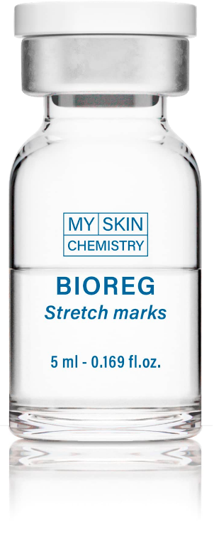 BIOREG STRETCH MARKS